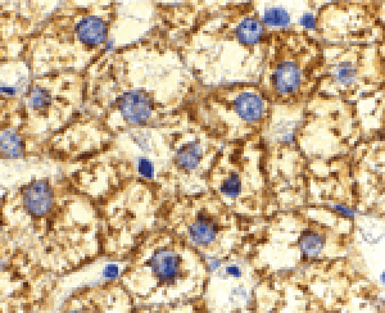 Immunohistochemistry - Akt1 Antibody from Signalway Antibody (24316) - Antibodies.com