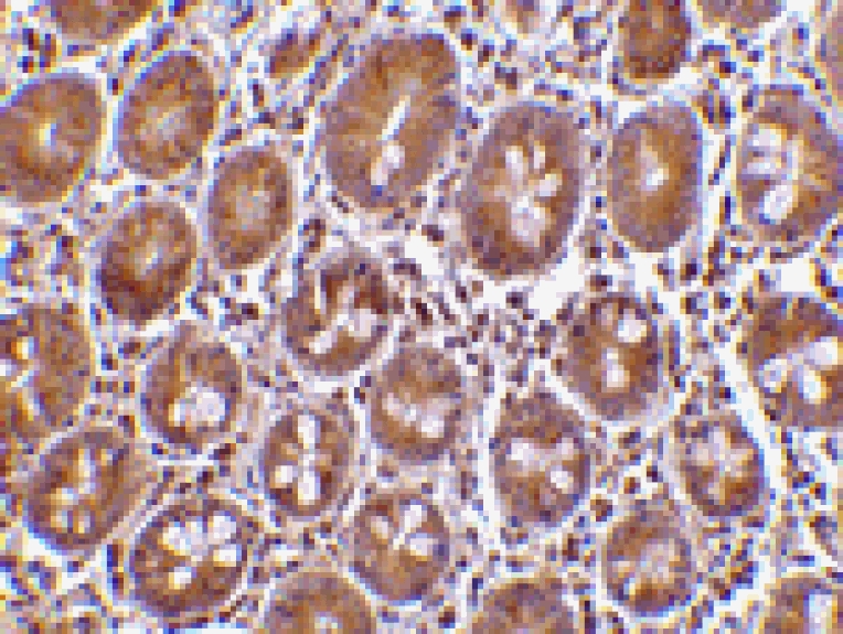 Immunohistochemistry - Bit1 Antibody from Signalway Antibody (24348) - Antibodies.com