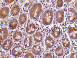 Immunohistochemistry - Bit1 Antibody from Signalway Antibody (24348) - Antibodies.com