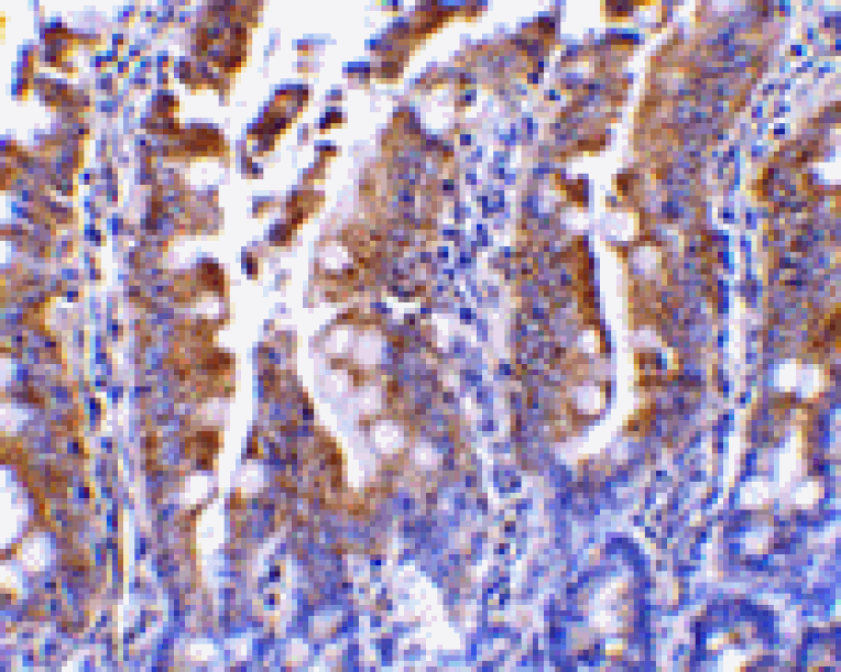 Immunohistochemistry - PIST Antibody from Signalway Antibody (24359) - Antibodies.com