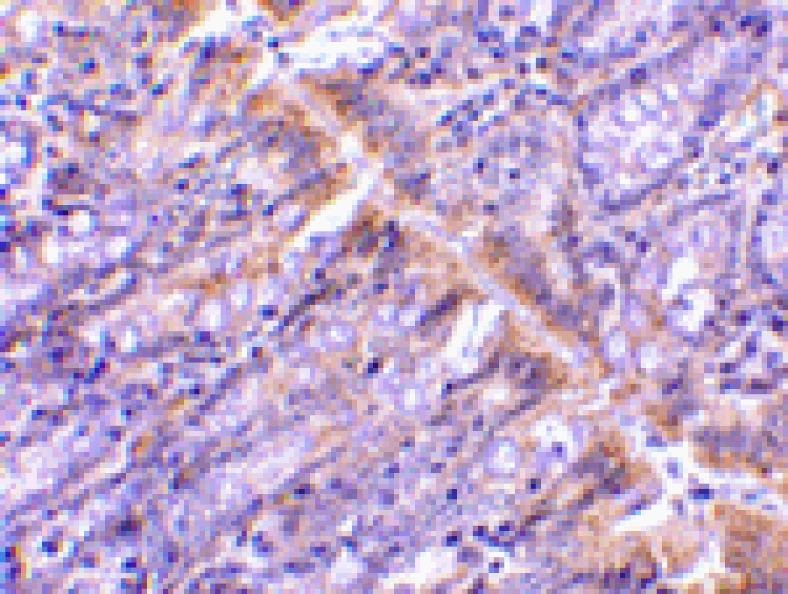 Immunohistochemistry - PIST Antibody from Signalway Antibody (24360) - Antibodies.com