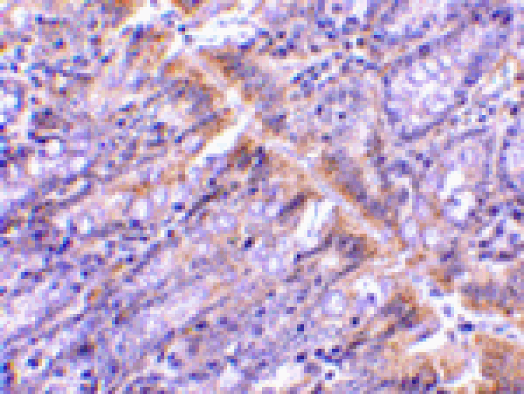 Immunohistochemistry - PIST Antibody from Signalway Antibody (24360) - Antibodies.com