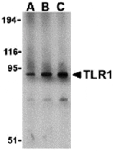 Western blot - TLR1 Antibody from Signalway Antibody (24361) - Antibodies.com