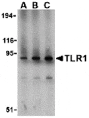 Western blot - TLR1 Antibody from Signalway Antibody (24361) - Antibodies.com