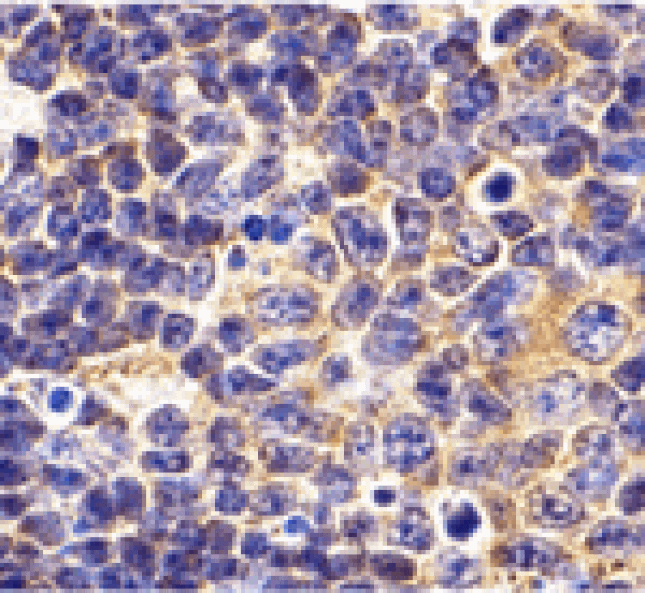 Immunohistochemistry - TLR1 Antibody from Signalway Antibody (24361) - Antibodies.com