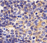 Immunohistochemistry - TLR1 Antibody from Signalway Antibody (24361) - Antibodies.com