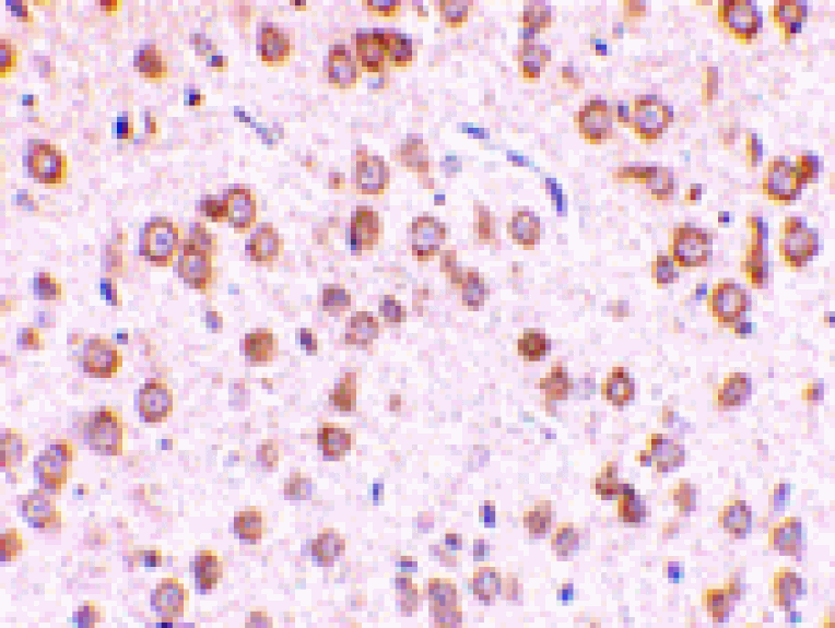 Immunohistochemistry - TLR5 Antibody from Signalway Antibody (24365) - Antibodies.com