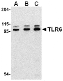 Western blot - TLR6 Antibody from Signalway Antibody (24368) - Antibodies.com