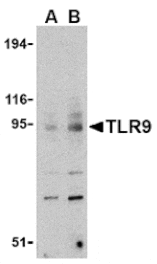 Western blot - TLR9 Antibody from Signalway Antibody (24386) - Antibodies.com
