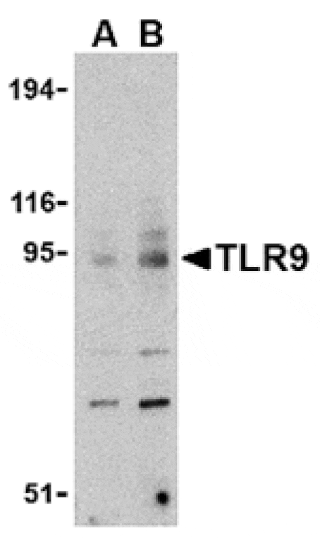 Western blot - TLR9 Antibody from Signalway Antibody (24386) - Antibodies.com