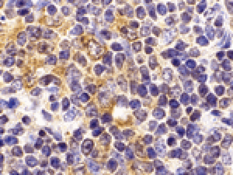 Immunohistochemistry - TLR9 Antibody from Signalway Antibody (24386) - Antibodies.com