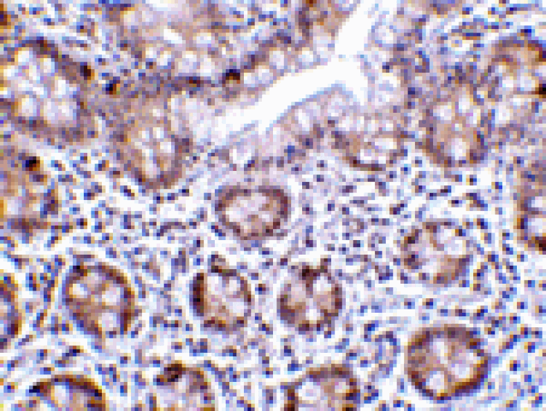 Immunohistochemistry - LSD1 Antibody from Signalway Antibody (24398) - Antibodies.com