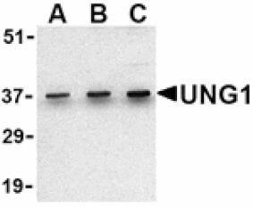 Western blot - UNG1 Antibody from Signalway Antibody (24431) - Antibodies.com