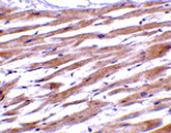 Immunohistochemistry - UNG1 Antibody from Signalway Antibody (24431) - Antibodies.com