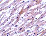 Immunohistochemistry - UNG1 Antibody from Signalway Antibody (24432) - Antibodies.com