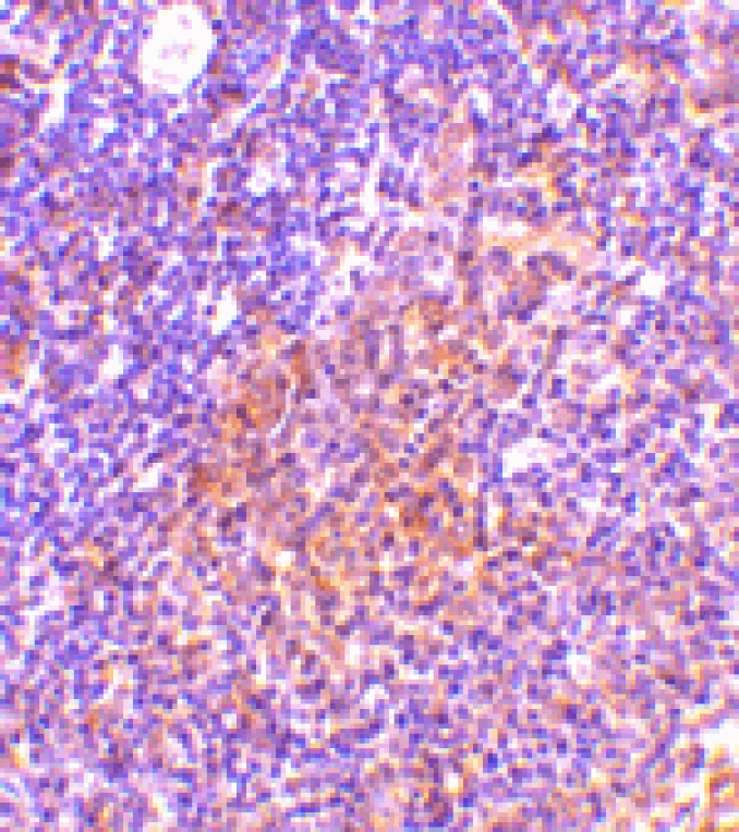 Immunohistochemistry - TANK Antibody from Signalway Antibody (24437) - Antibodies.com