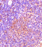 Immunohistochemistry - TANK Antibody from Signalway Antibody (24437) - Antibodies.com