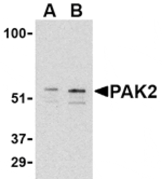 Western blot - PAK2 Antibody from Signalway Antibody (24441) - Antibodies.com