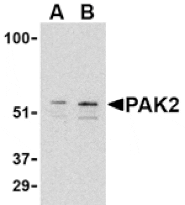 Western blot - PAK2 Antibody from Signalway Antibody (24441) - Antibodies.com