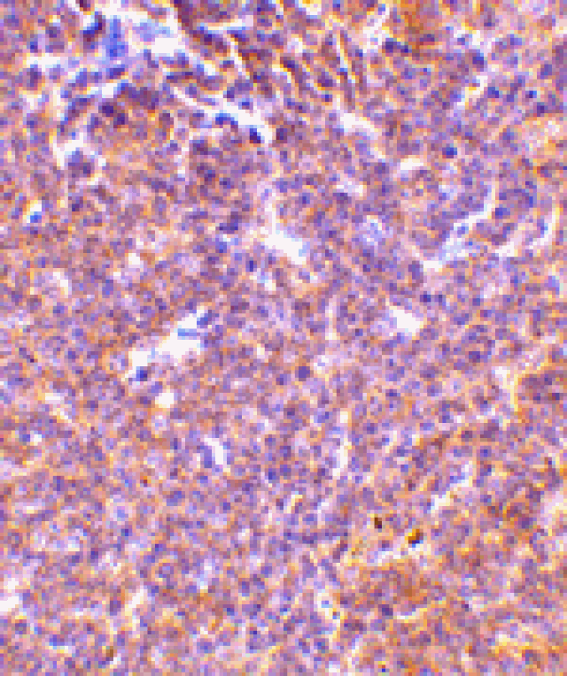 Immunohistochemistry - PAK2 Antibody from Signalway Antibody (24441) - Antibodies.com