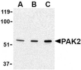 Western blot - PAK2 Antibody from Signalway Antibody (24442) - Antibodies.com