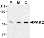 Western blot - PAK2 Antibody from Signalway Antibody (24442) - Antibodies.com
