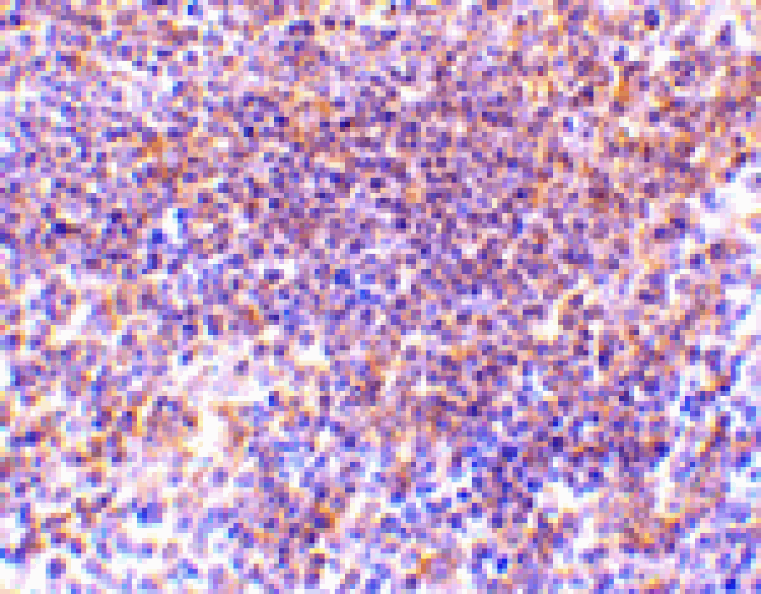 Immunohistochemistry - PAK2 Antibody from Signalway Antibody (24442) - Antibodies.com