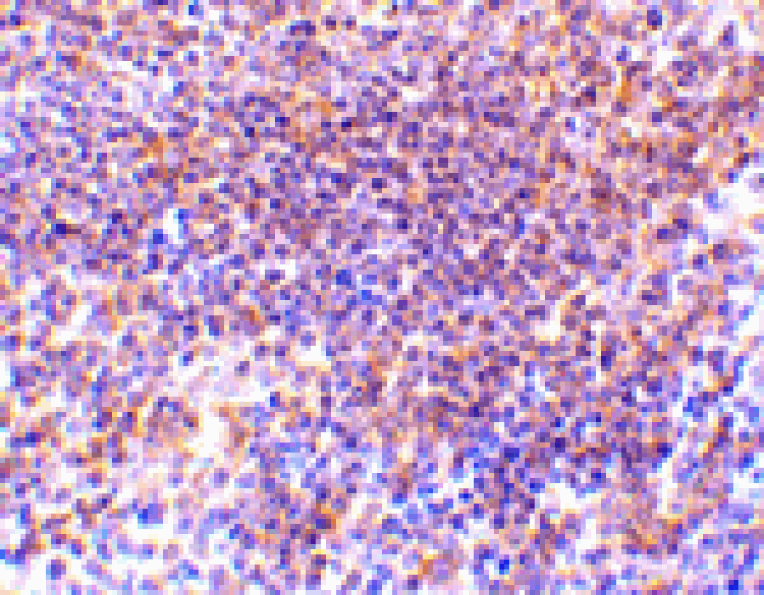 Immunohistochemistry - PAK2 Antibody from Signalway Antibody (24442) - Antibodies.com