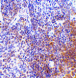 Immunohistochemistry - IRF7 Antibody from Signalway Antibody (24455) - Antibodies.com