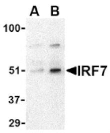 Western blot - IRF7 Antibody from Signalway Antibody (24456) - Antibodies.com