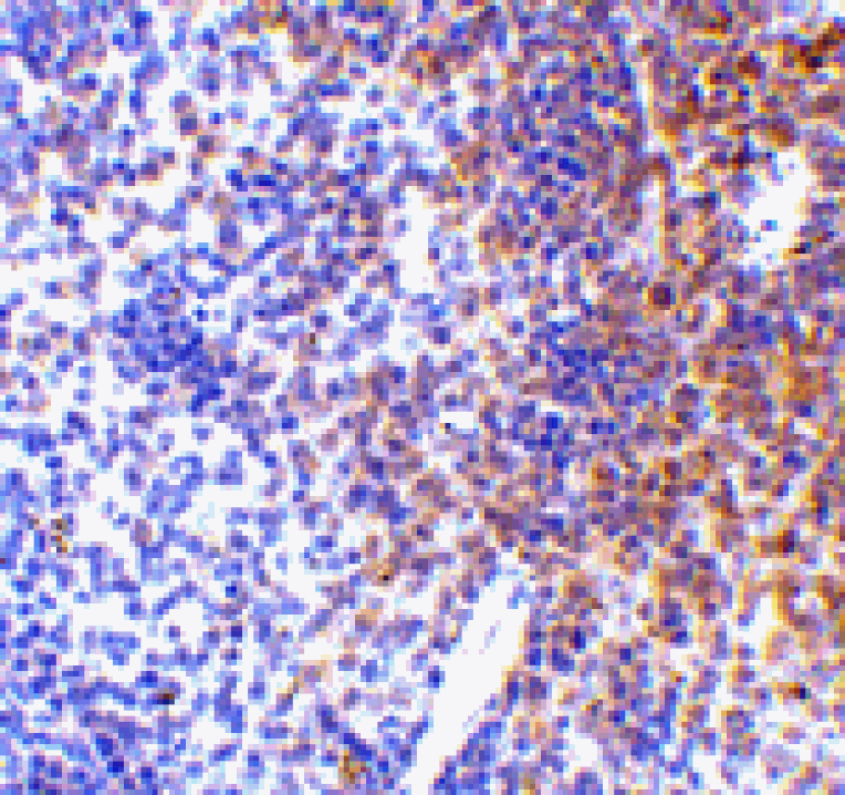 Immunohistochemistry - IRF7 Antibody from Signalway Antibody (24456) - Antibodies.com