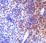 Immunohistochemistry - IRF7 Antibody from Signalway Antibody (24456) - Antibodies.com