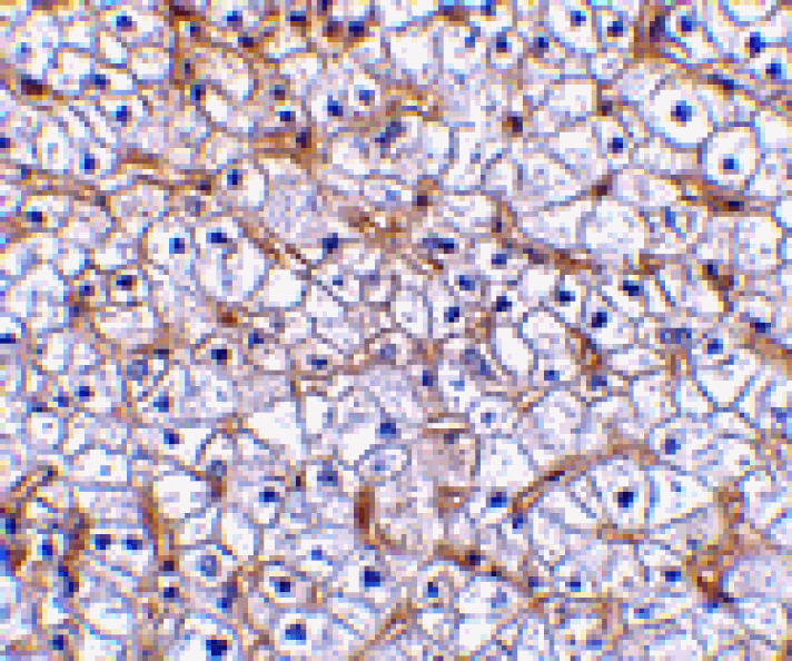 Immunohistochemistry - Fn14 Antibody from Signalway Antibody (24460) - Antibodies.com