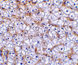 Immunohistochemistry - Fn14 Antibody from Signalway Antibody (24460) - Antibodies.com