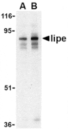 Western blot - Lipe Antibody from Signalway Antibody (24465) - Antibodies.com