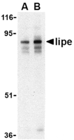 Western blot - Lipe Antibody from Signalway Antibody (24465) - Antibodies.com