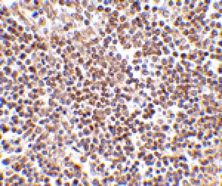 Immunohistochemistry - Lipe Antibody from Signalway Antibody (24465) - Antibodies.com
