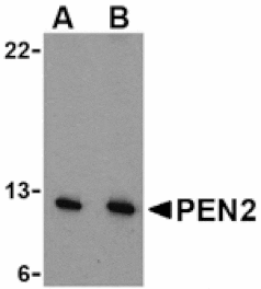Western blot - PEN2 Antibody from Signalway Antibody (24470) - Antibodies.com