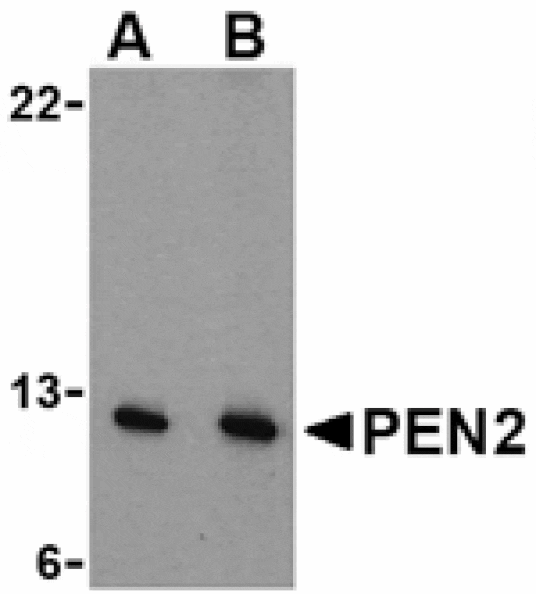 Western blot - PEN2 Antibody from Signalway Antibody (24470) - Antibodies.com