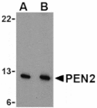 Western blot - PEN2 Antibody from Signalway Antibody (24470) - Antibodies.com
