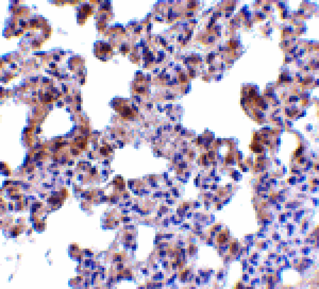 Immunohistochemistry - PEN2 Antibody from Signalway Antibody (24470) - Antibodies.com