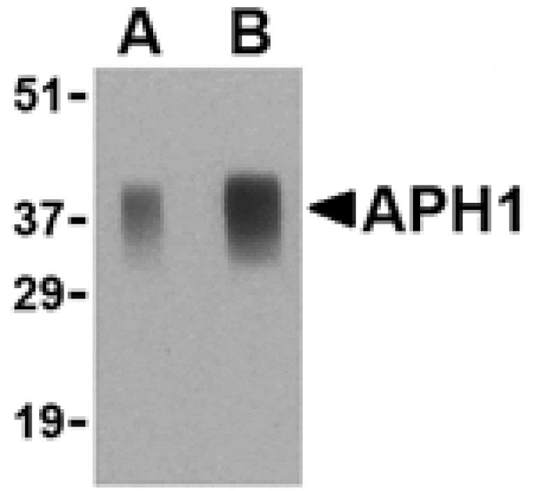Western blot - APH1 Antibody from Signalway Antibody (24480) - Antibodies.com