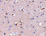Immunohistochemistry - APH1 Antibody from Signalway Antibody (24480) - Antibodies.com