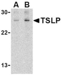 Western blot - TSLP Antibody from Signalway Antibody (24486) - Antibodies.com