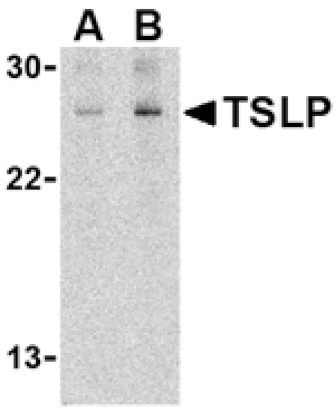 Western blot - TSLP Antibody from Signalway Antibody (24486) - Antibodies.com