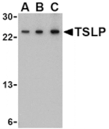 Western blot - TSLP Antibody from Signalway Antibody (24487) - Antibodies.com