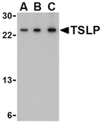 Western blot - TSLP Antibody from Signalway Antibody (24487) - Antibodies.com