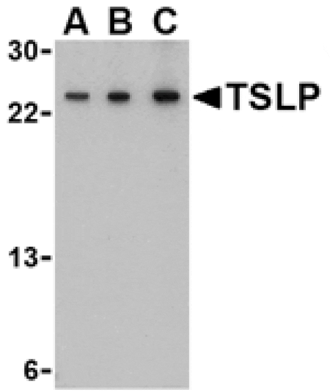 Western blot - TSLP Antibody from Signalway Antibody (24487) - Antibodies.com
