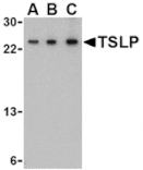 Western blot - TSLP Antibody from Signalway Antibody (24487) - Antibodies.com