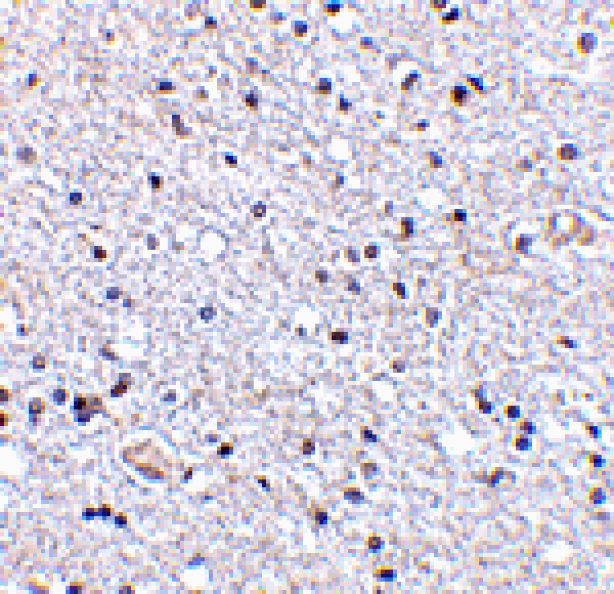 Immunohistochemistry - TSLP Antibody from Signalway Antibody (24487) - Antibodies.com